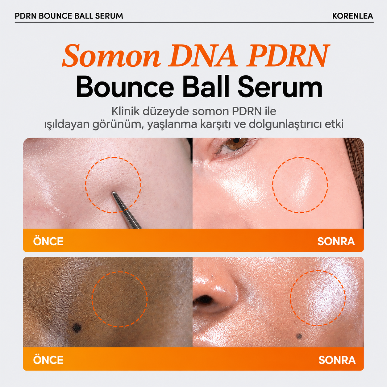 Korenlea™ PDRN Bounce Ball Serum
