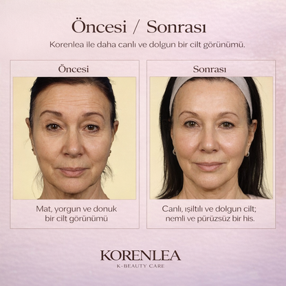 Korenlea ™ Aydınlatıcı Anti Aging Altın Capsule Cream