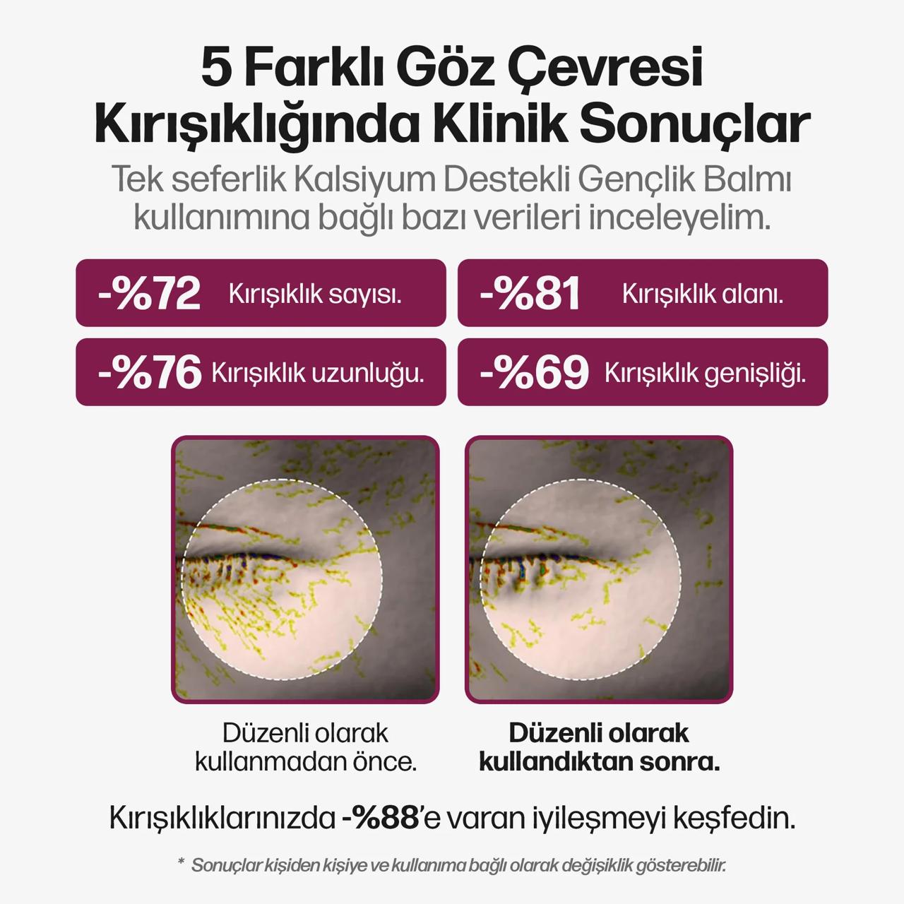 Korenlea ™ Kalsiyum Multi Balm (9ml)