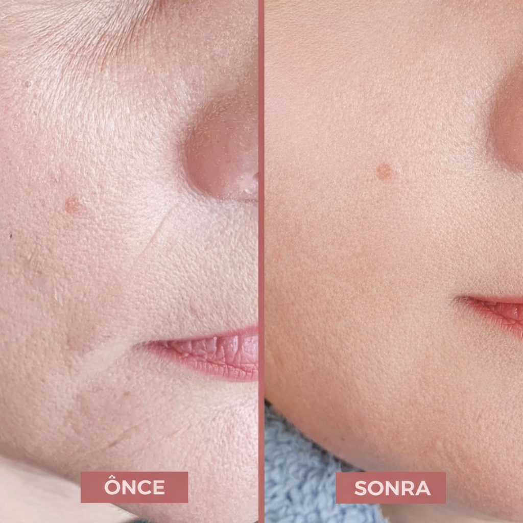 Korenlea ™ Somon Collagen PDRN Multi Balm (20ml)