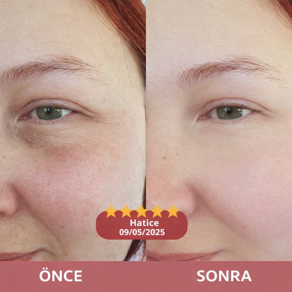 Korenlea ™ Somon Collagen PDRN Multi Balm (20ml)