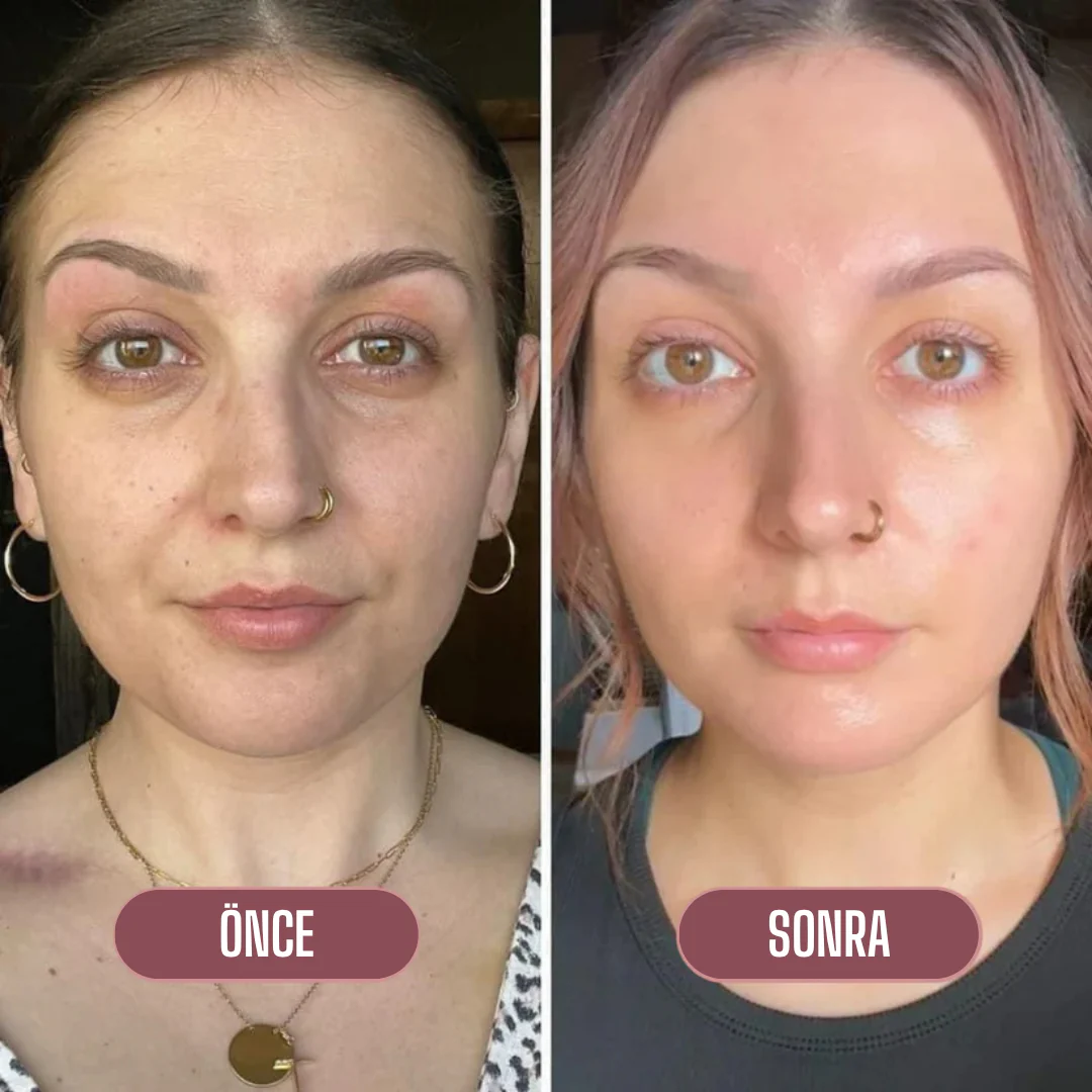 Korenlea ™ Somon Collagen PDRN Multi Balm (16ml)