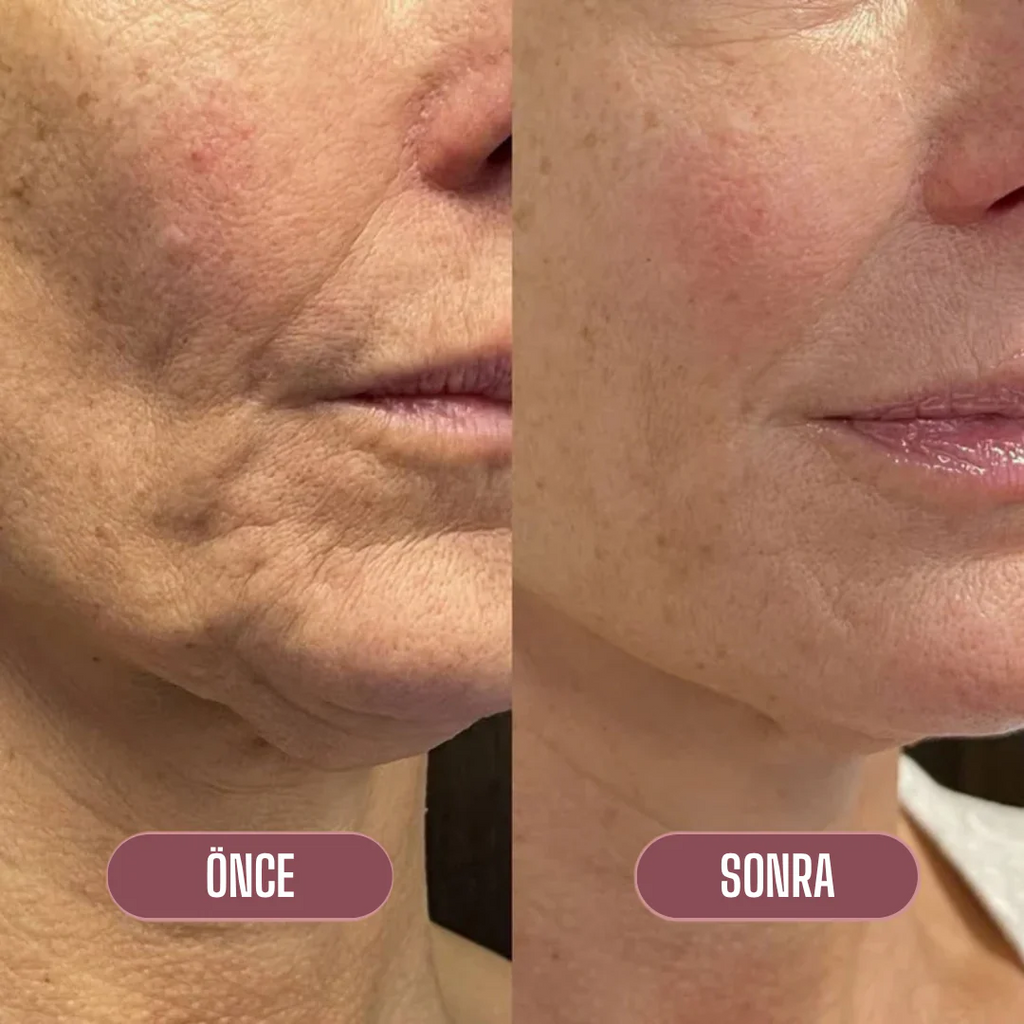 Korenlea ™ Somon Collagen PDRN Multi Balm (20ml)