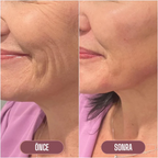 Korenlea ™ Somon Collagen PDRN Multi Balm (20ml)