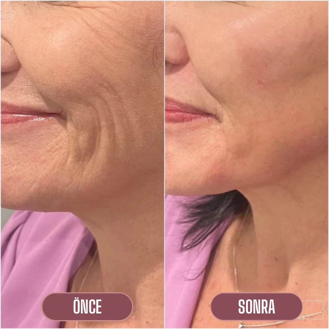 Korenlea ™ Somon Collagen PDRN Multi Balm (20ml)