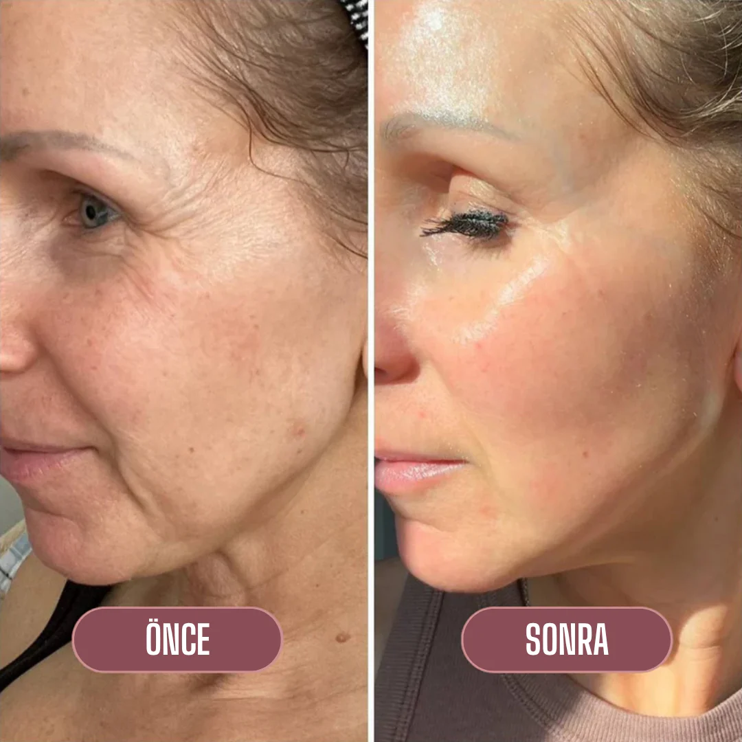 Korenlea ™ Somon Collagen PDRN Multi Balm (16ml)